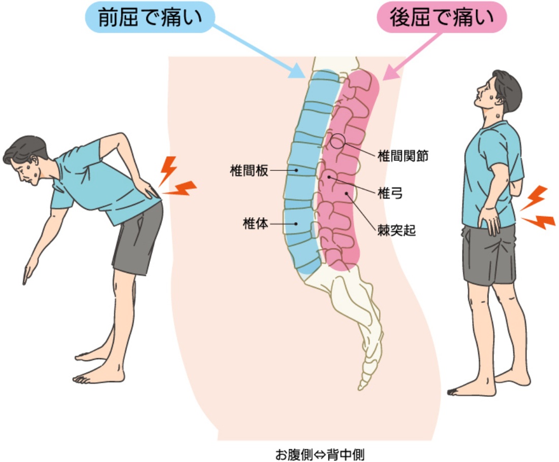 腰バキバキ